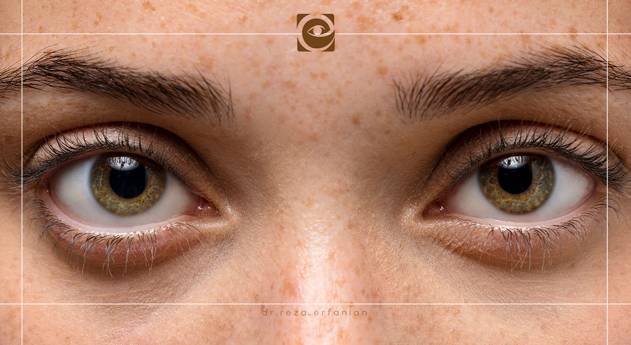 آناتومی و ساختار عنبیه