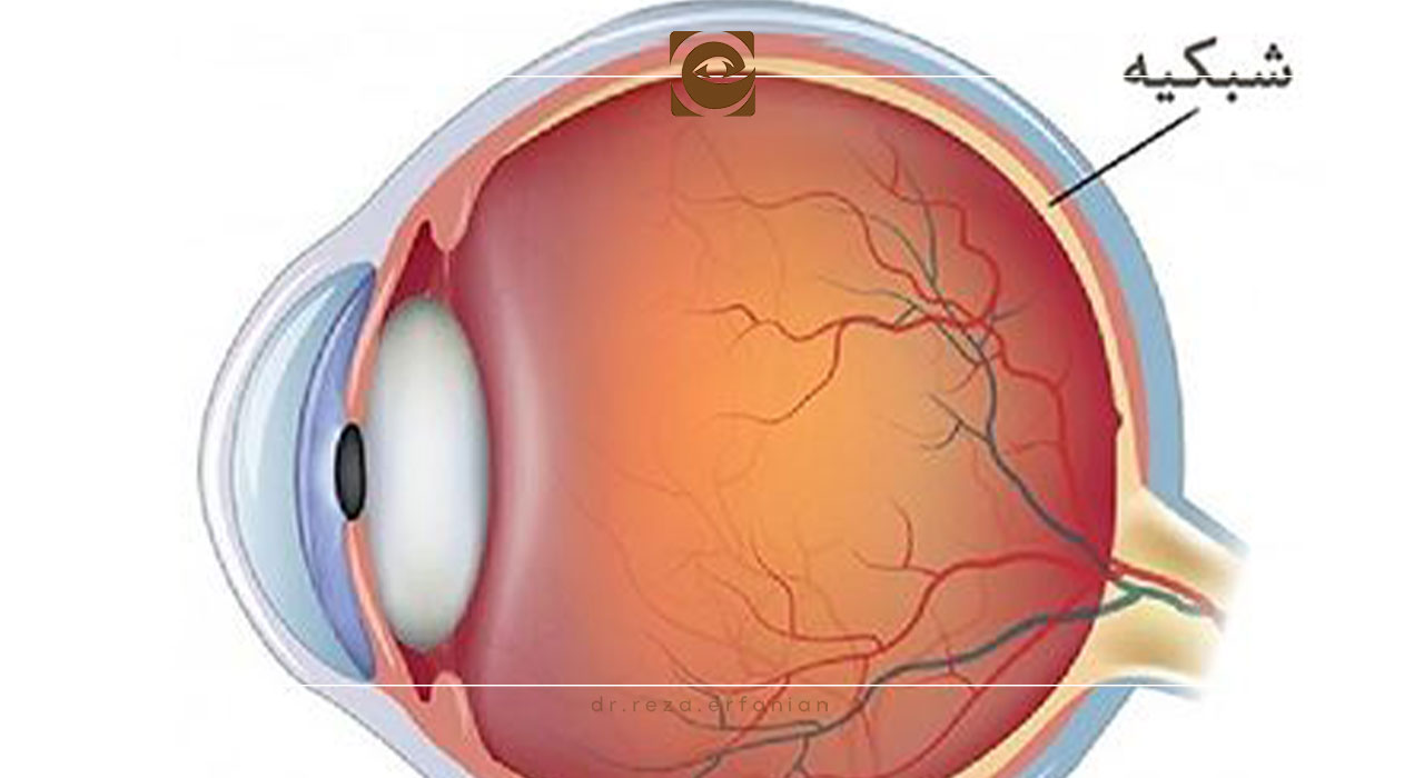 درمان بیماری های شبکیه