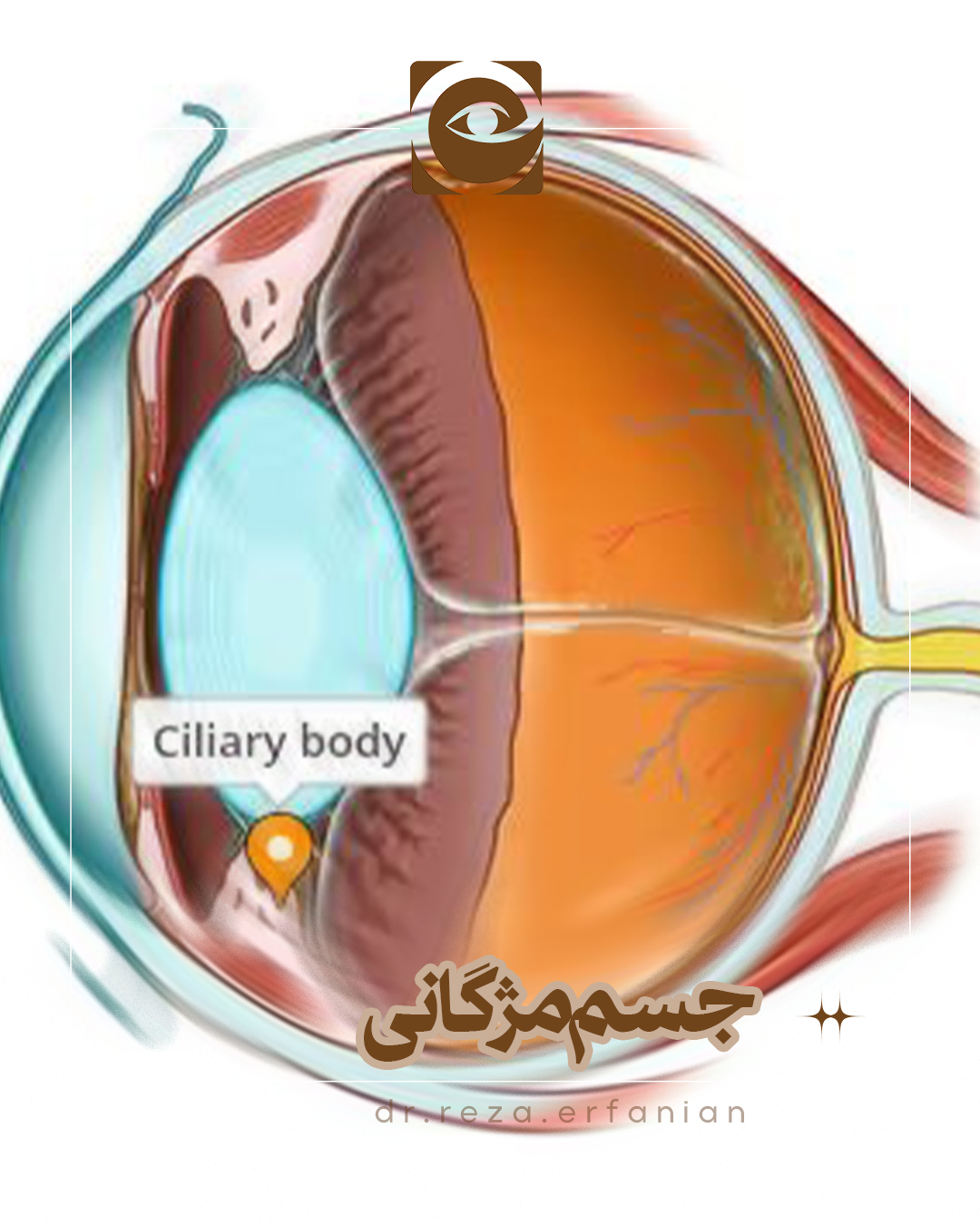 جسم مژگانی