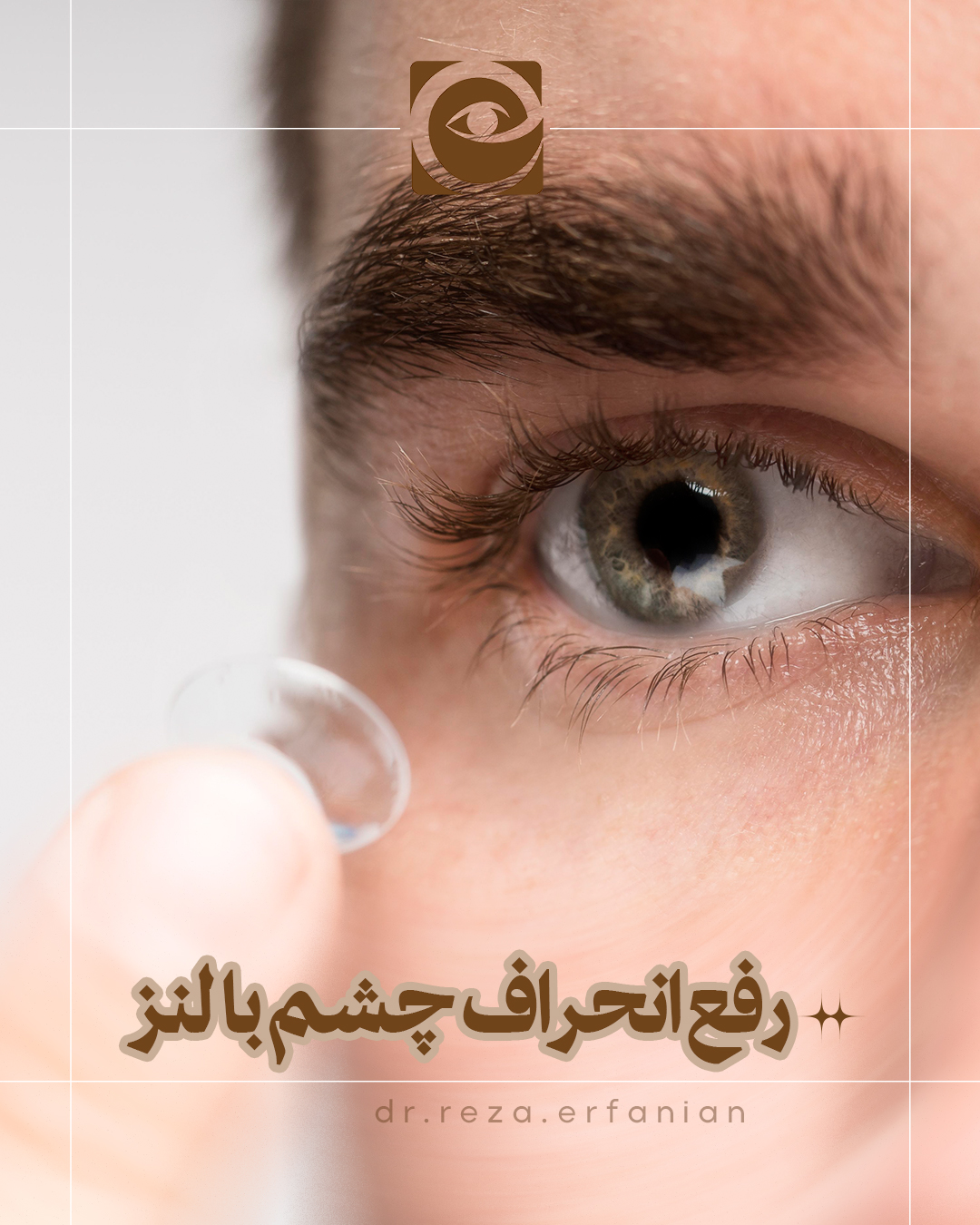 رفع انحراف چشم با لنز