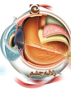 زلالیه چشم