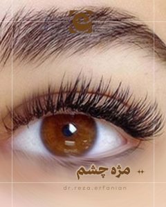 مژه چشم