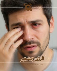آلرژی چشمی چیست؟
