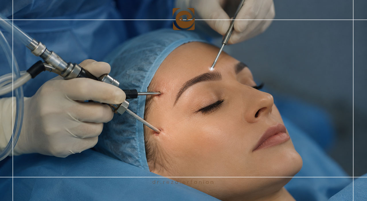 مزیتهای لیفت اندوسکوپیک ابرو